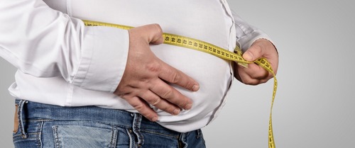 obesity  